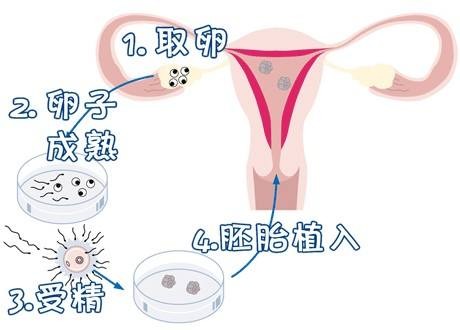 冷冻设备
